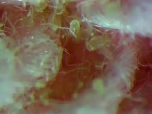 螨虫走开！中疾控检测100%有效，家有小宝、消除过敏源必备