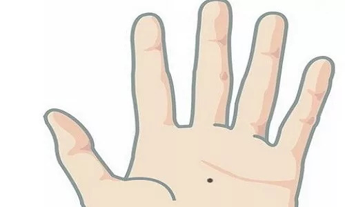 色素痣如何激光祛疤,激光祛完色素痣多久可以打粉底液