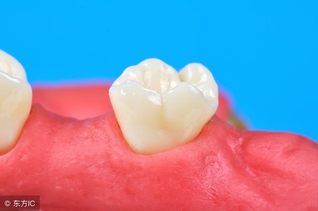 长了智齿拔掉多少钱,长了智齿怎么办要不要拔掉