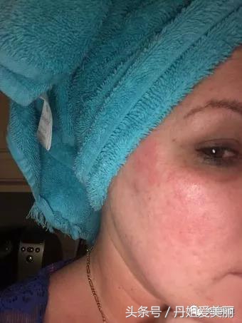 10鍏冨乏鍙崇殑moc,10鍏冪殑moc