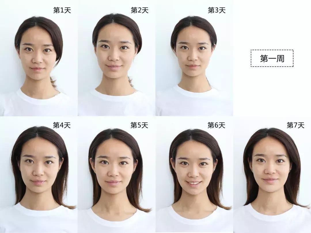 vc精华去法令纹,vc可以消除法令纹吗