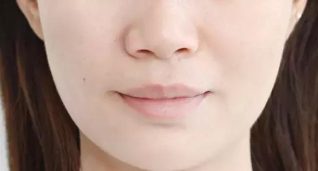 vc精华淡化法令纹暗沉,vc用了法令纹发黄