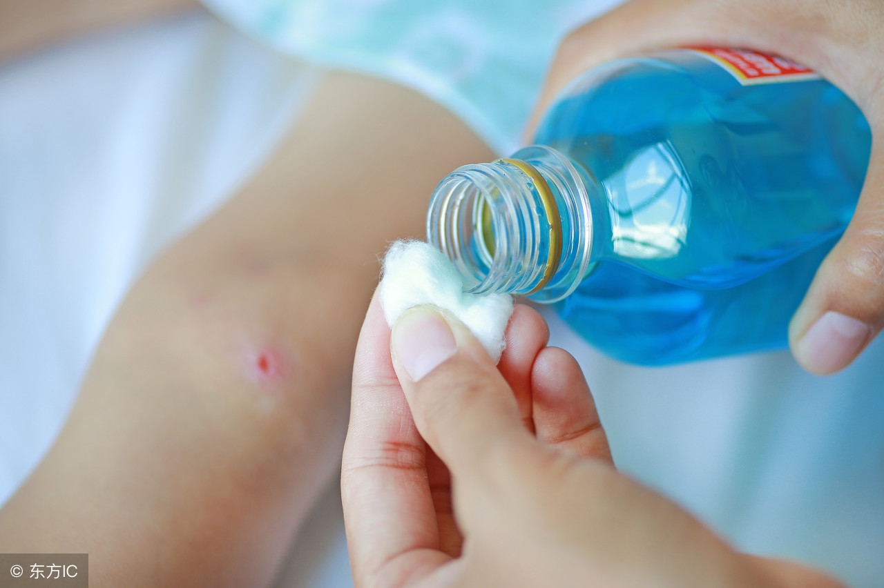 狂犬病毒发作后还有救吗,被未携带狂犬病毒的狗咬伤怎么办