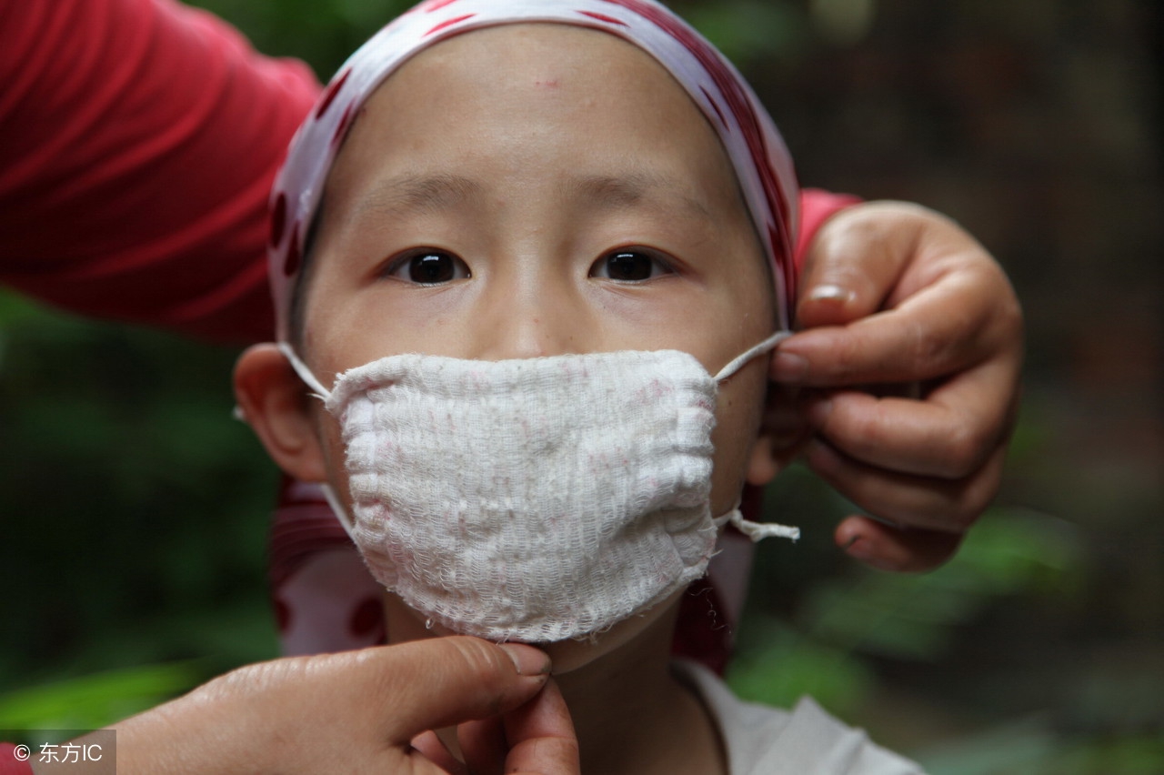 白血病患儿的感染问题，白血病应该如何饮食治疗？