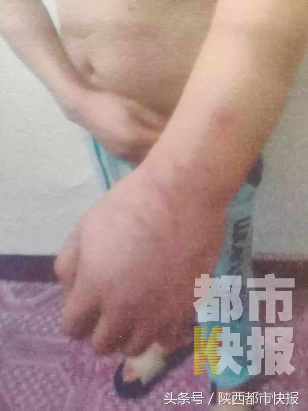 突然反目！礼泉一男子被朋友挟持到水库拘禁脱衣殴打，就因为他