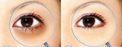 关于眼霜,关于眼袋你还有什么想知道的