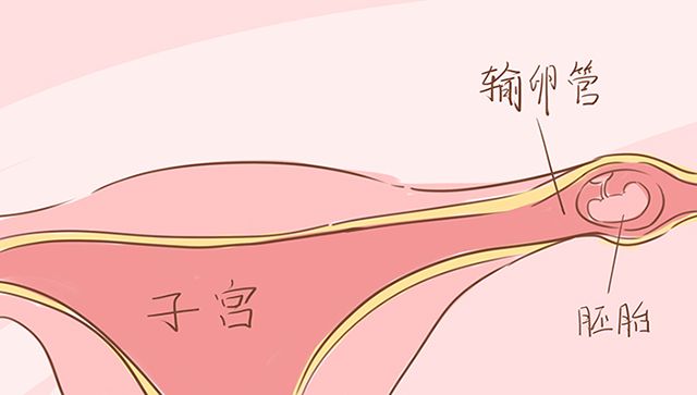 孕期肚子隐隐作痛是胃癌吗,孕期肚子疼是不是宝宝饿了