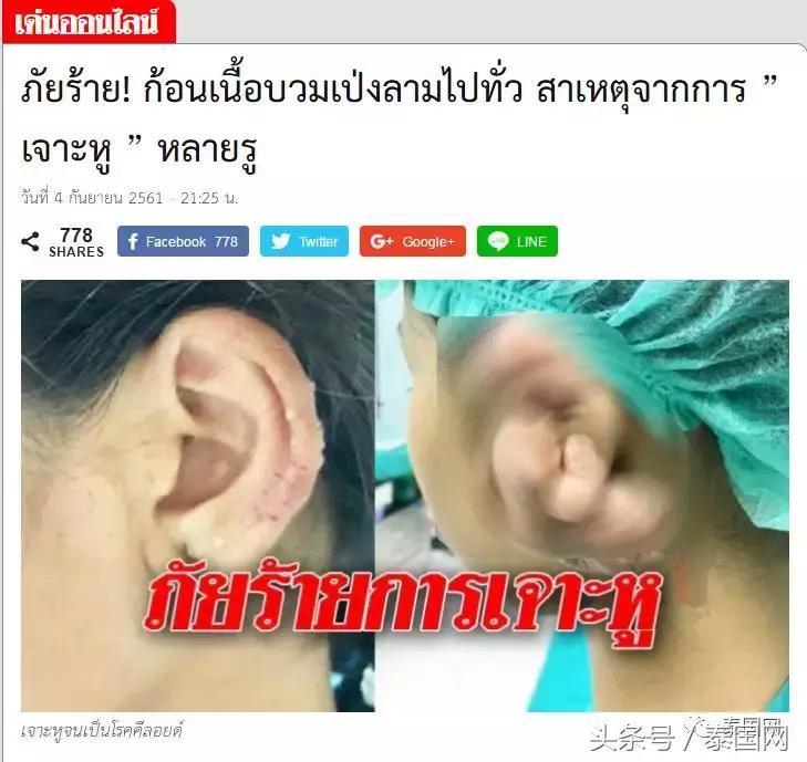 泰国女人打耳洞视频,泰国女子打耳洞