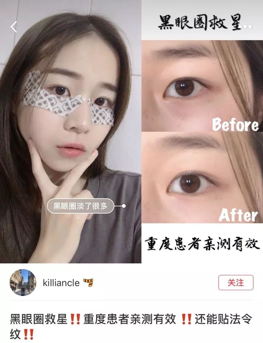 陆毅推荐眼膜,陆毅贝儿眼膜