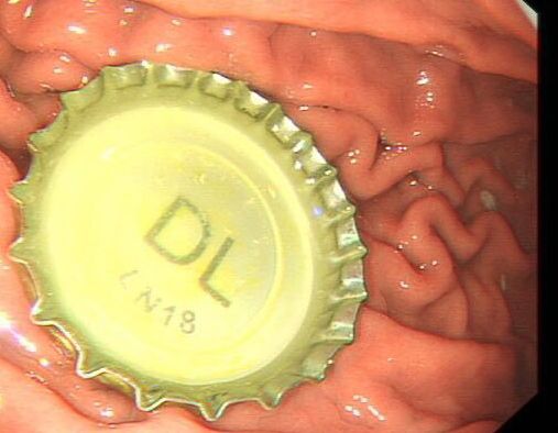 医生给患者做包皮手术被惊呆,医生动手术被惊呆