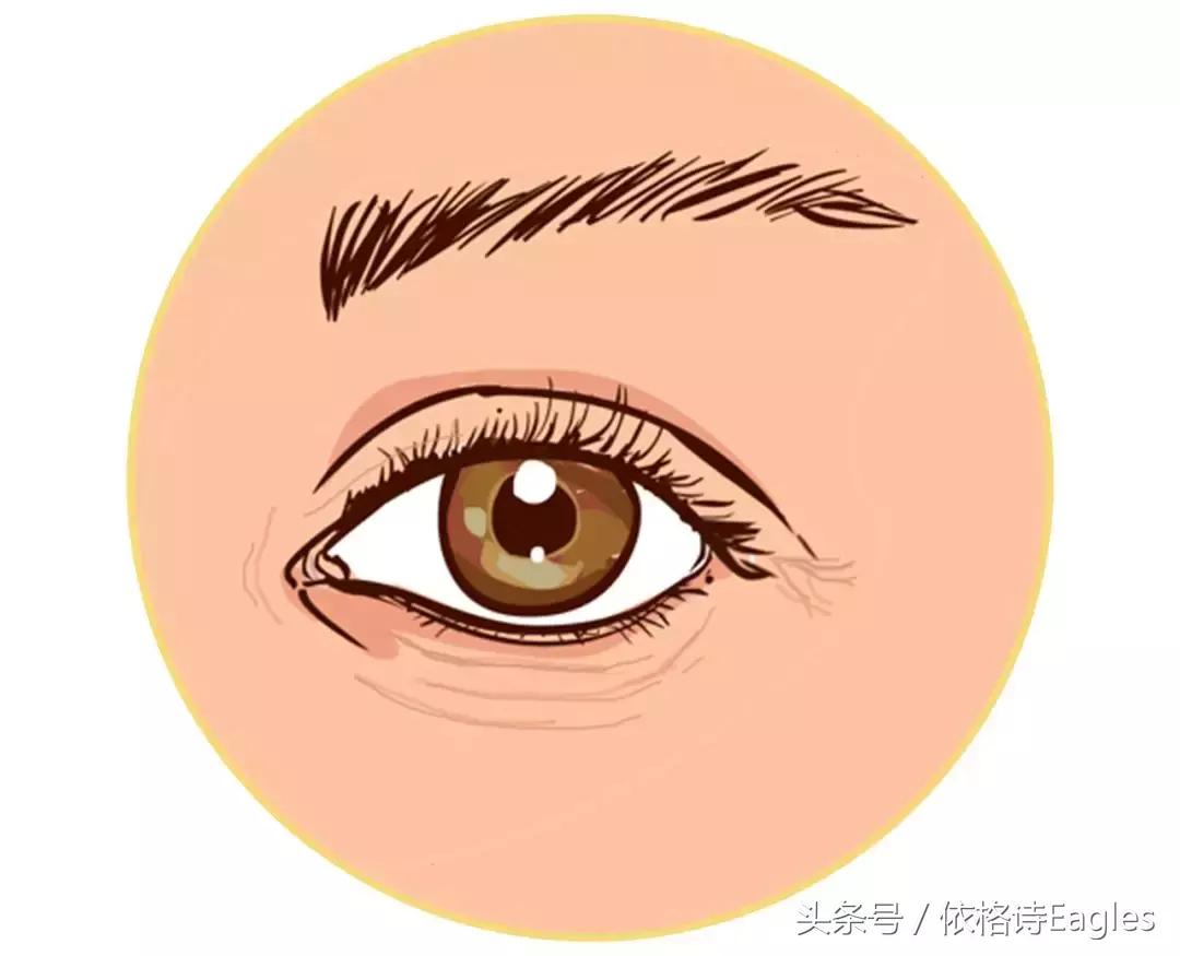 黑眼圈色素沉淀还有救吗,细纹黑眼圈用什么眼霜