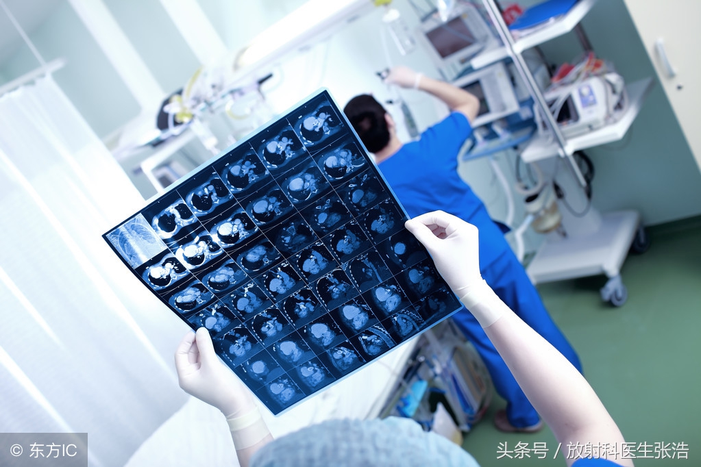 恶性胸腔积液诊断与治疗专家共识,有胸腔积液是结核性胸膜炎吗