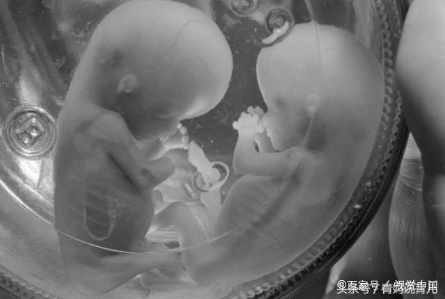 孕期动了胎气会有什么症状,孕妇胎气都有哪些表现