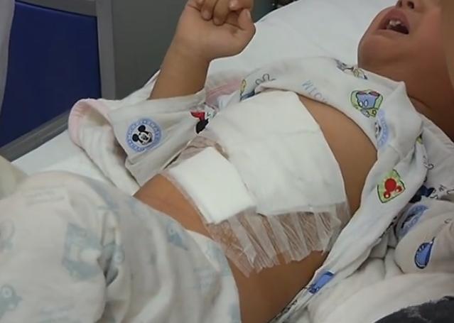 两岁半宝宝体内藏针,两岁儿童缝衣针