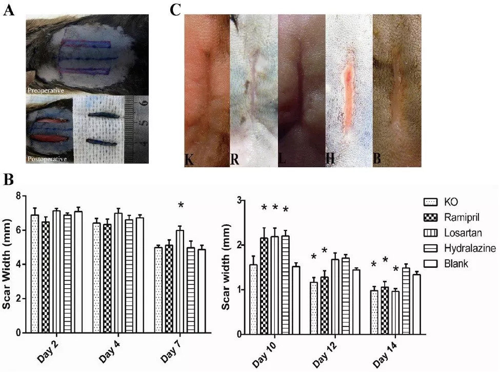 什么降压药保护皮肤,什么降压药对皮肤无副作用
