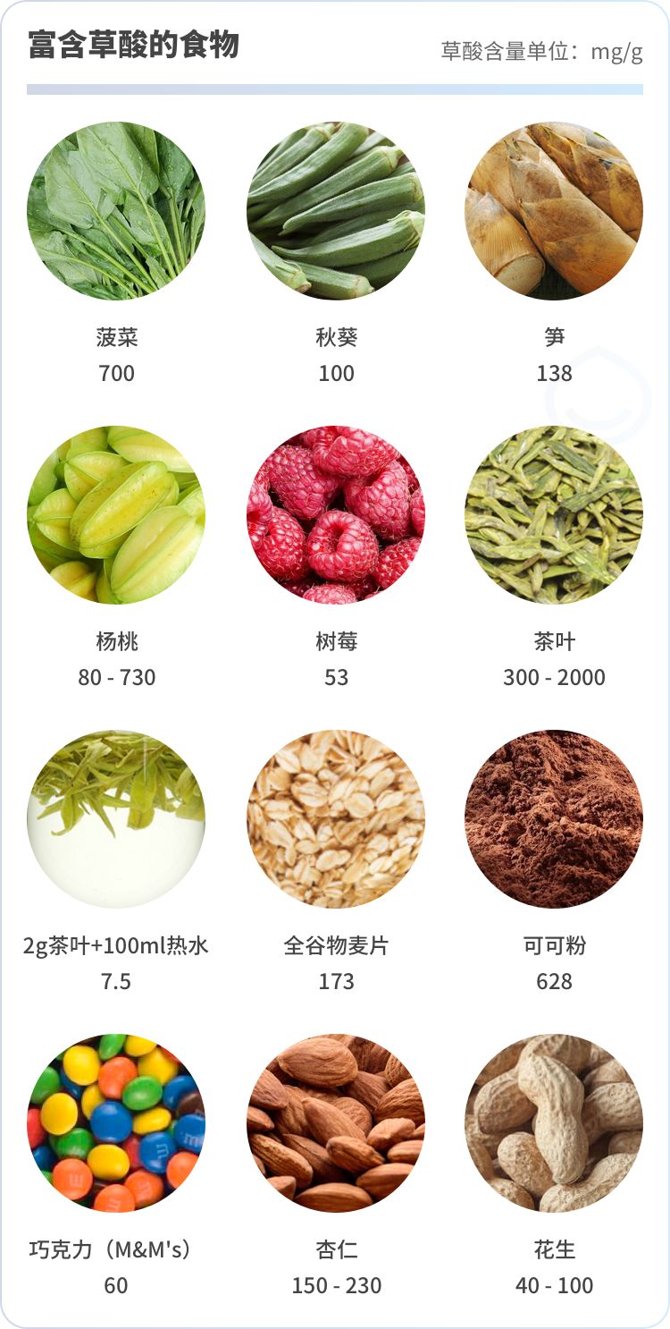 肾结石的饮食与禁忌,肾结石饮食禁忌食谱一览表