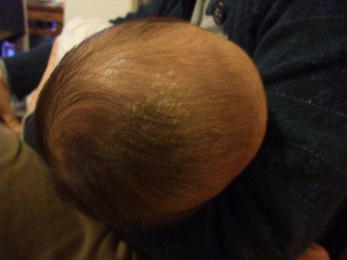 宝宝胀气大便拉不出来吐奶,宝宝肠鸣腹泻吐奶怎么回事