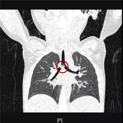 一些让人毛骨悚然拍到的照片,六个令人毛骨悚然的影像
