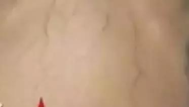 警惕肝脏的5个征兆,肝青筋