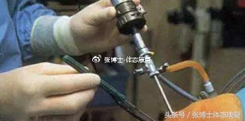 膝关节滑膜皱襞综合征锻炼,膝关节滑膜皱襞综合征怎么治