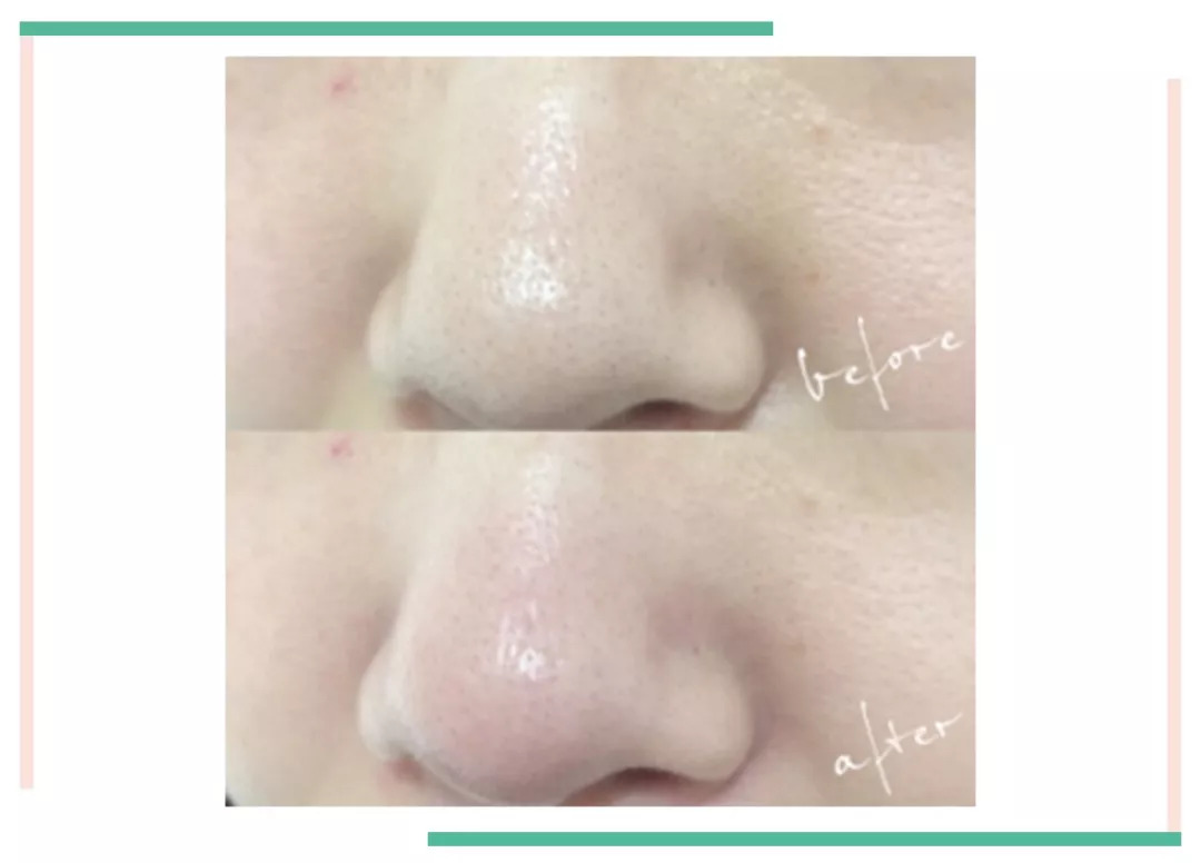 鸡冻僵复活,鸡冻了能救活吗