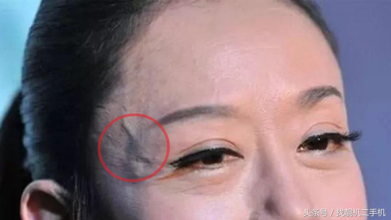 为什么人手上有青筋爆出来,50岁女人手上青筋暴起怎么回事