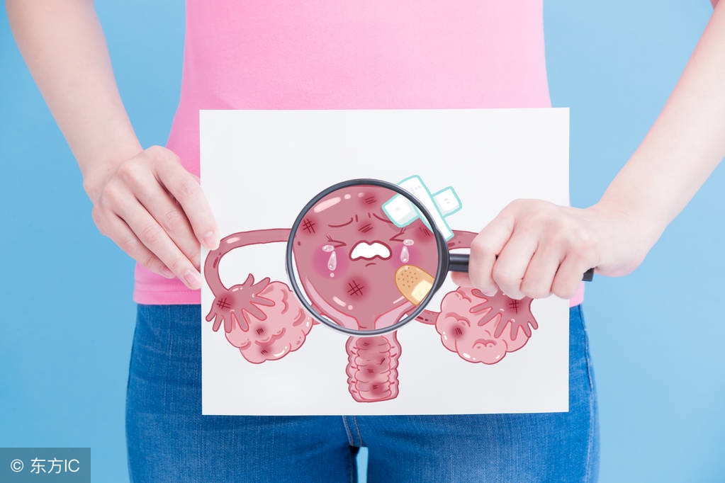 宫颈炎都有哪些症状?得了宫颈炎怎么办?