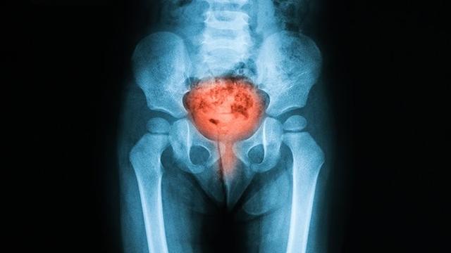 高中班花联系我，只为了问“为什么和丈夫那个后会尿痛尿血”