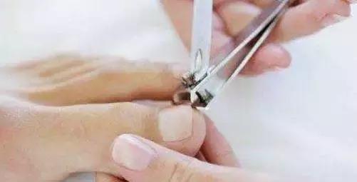 脚磨破皮不出血但很痛,脚磨破皮一直不结痂