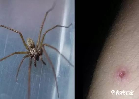 男子被马蜂蛰三下后去世,男子被黄蜂蜇致其身亡