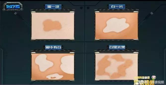 激光治疗和皮肤移植哪家强？治疗白癜风，最新黑科技大盘点