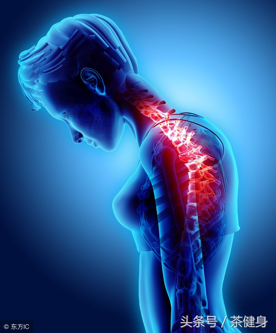 经常偏头痛练几个月健身就好,经常锻炼可以减轻偏头痛吗