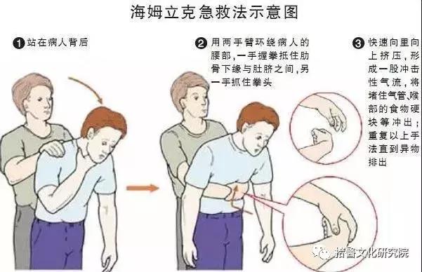 女子噎到男子急救,一名女子噎着了