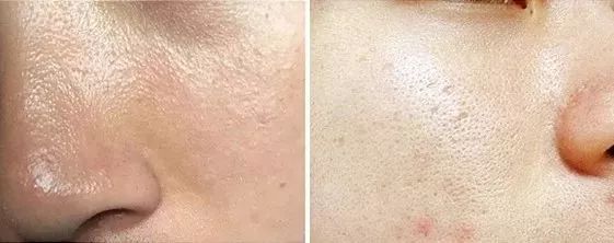 脸上污垢,脸上的脏东西真能清理出来吗