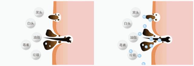 脸上污垢,脸上的脏东西真能清理出来吗