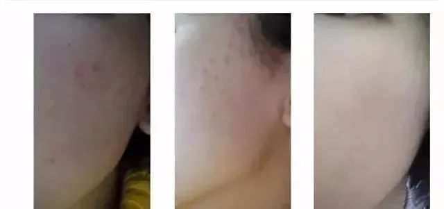 30块钱平价好物,大牌面膜平价替代