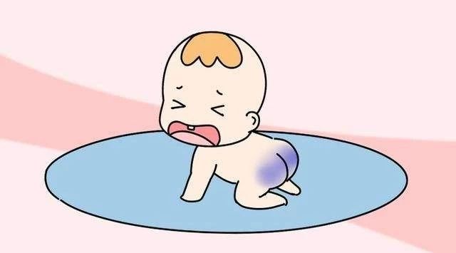 宝宝屁股上有青印,宝宝屁股上有划痕是什么情况