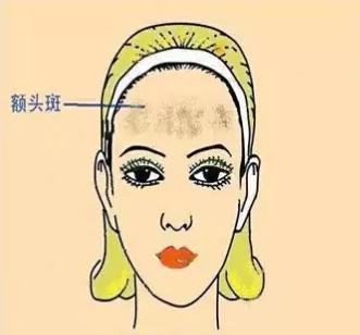 如何识别各种不同的斑,不同位置的色斑叫什么