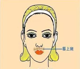 如何识别各种不同的斑,不同位置的色斑叫什么