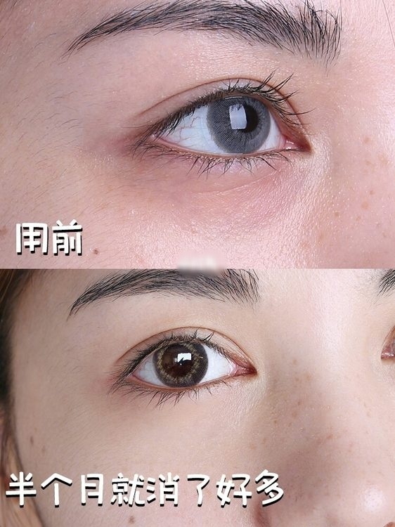 凡士林加维生素e乳淡化眼纹,凡士林抗皱眼膜