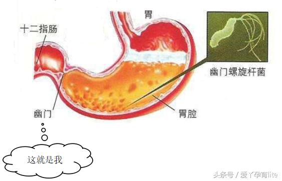 坐拥500吨美钞的发哥，拉的屎是不是金光闪闪的？