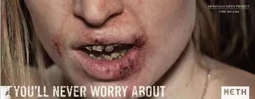 这一口烂牙，就能让你意识到*品毒**的破坏力有多恐怖