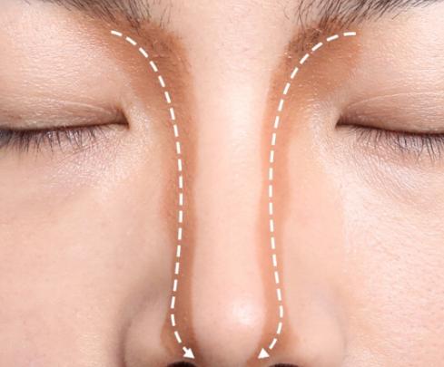 为什么有人的鼻子那么小,鼻子不够挺是什么原因