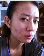 卸妆没卸干净的后果是什么,不卸妆好不好