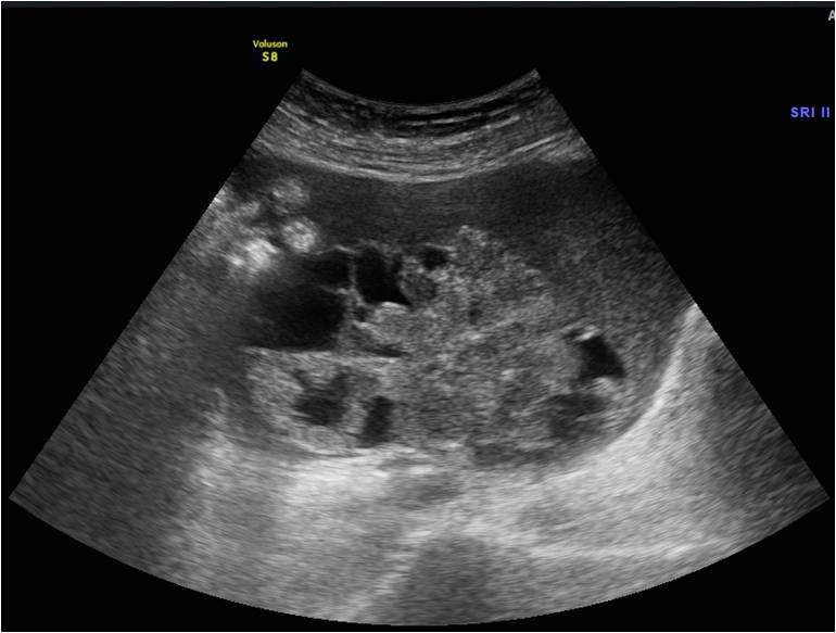 4种癌症影响女人一生健康！