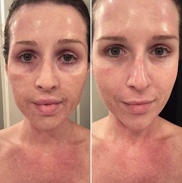 扒一扒那些好用的面膜,盘点几款难用的面膜