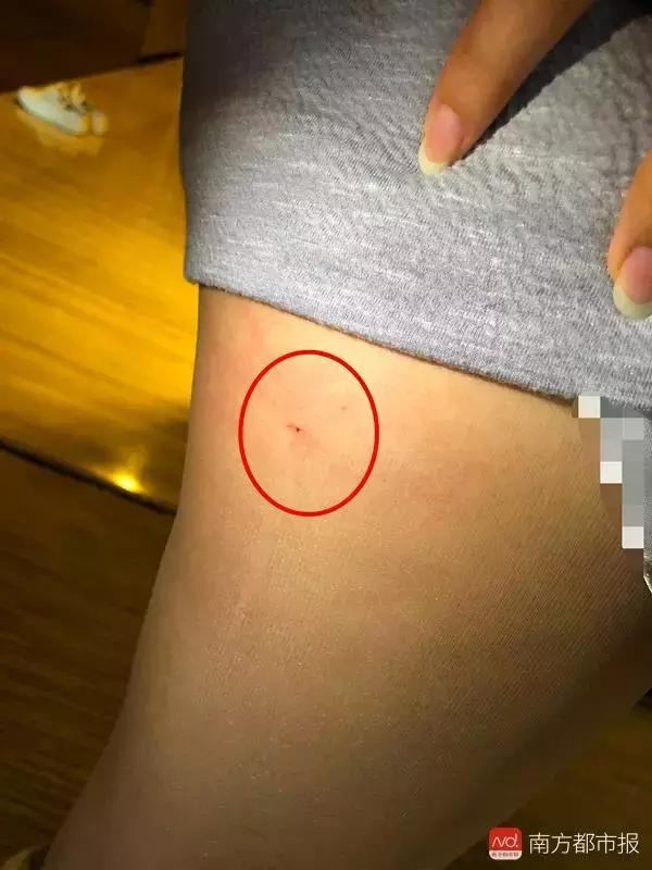 酒店床上有钉子,酒店床上有根针怎么办