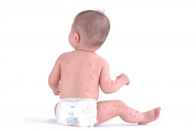 痘痘可以等它自然消失吗,痘痘消不掉有颗粒感