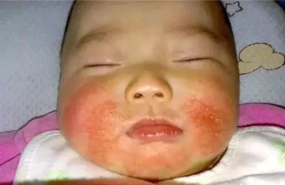 秋季孩子身上痒是什么原因,秋季宝宝身上起红疙瘩越挠越痒