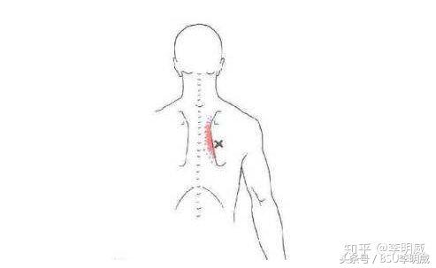 上背部有点不舒服是怎么回事,上背部发紧不舒服痛